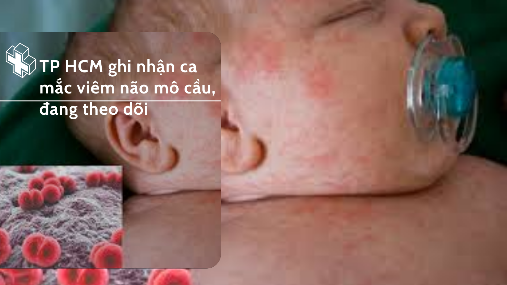TP HCM ghi nhận ca mắc viêm não mô cầu, đang theo dõi
